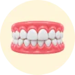 Invisalign treatment for overbite